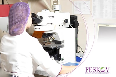 metodo di selezione del sesso