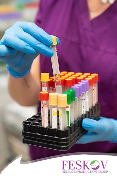 donatrice di ovuli con QI elevato