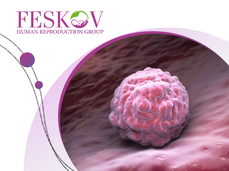 Preparazione endometriale per il trasferimento di embrioni: come funziona