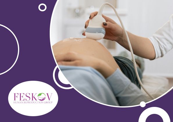 prezzo surrogato madre dei Paesi Bassi