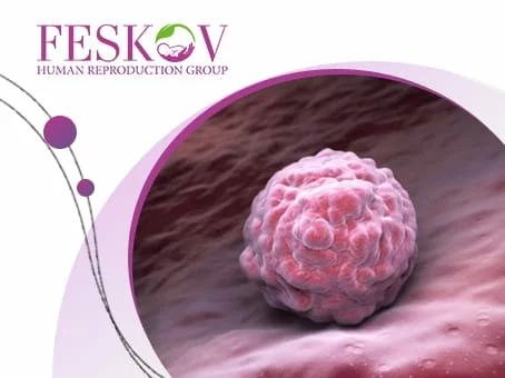 Preparazione endometriale per il trasferimento di embrioni: come funziona immagine
